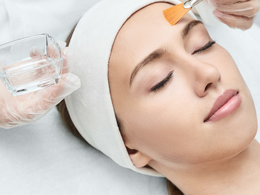 Chemical Peel