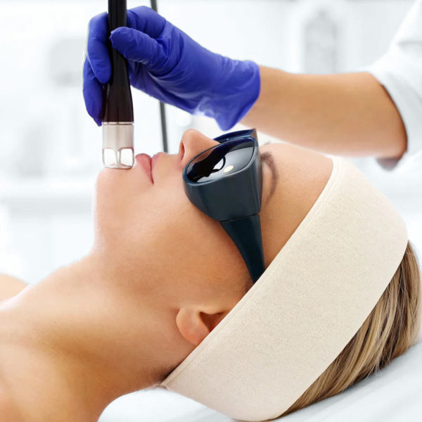 Deep Fractional Laser Resurfacing