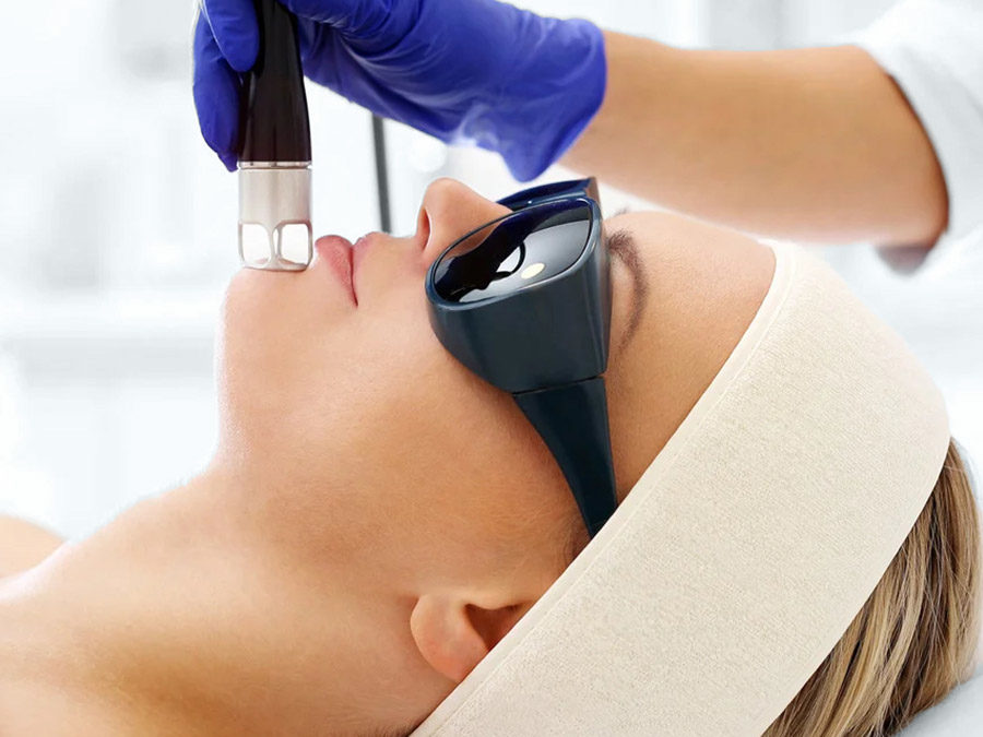 Deep Fractional Laser Resurfacing
